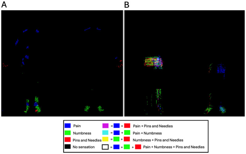 A Summary of Pain Locations and Neuropathic Patterns Extracted Automatically from Patient Self-Reported Sensation Drawings.