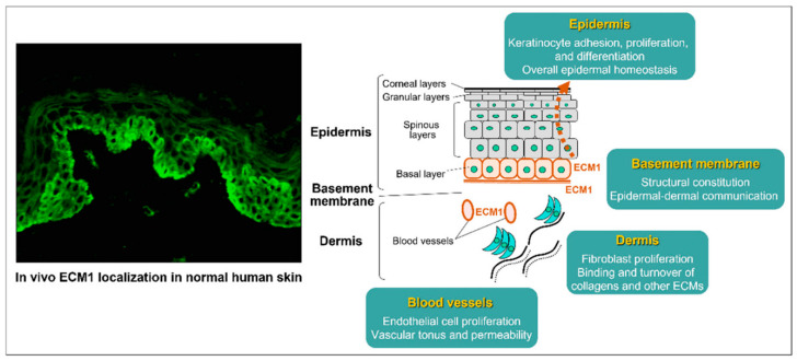 Exploring Genital Lichen Sclerosus: Navigating from Pathophysiology to Precise Diagnostic Approaches.