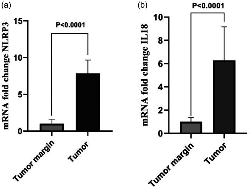 Expression analysis of NOD-like receptor protein 3 and interleukin-18 in basal cell carcinoma: A case-control study.