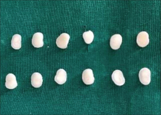 Microbrush bristle remnants on the bonding surface using different adhesive systems by scanning electron microscope: An <i>in vitro</i> study.