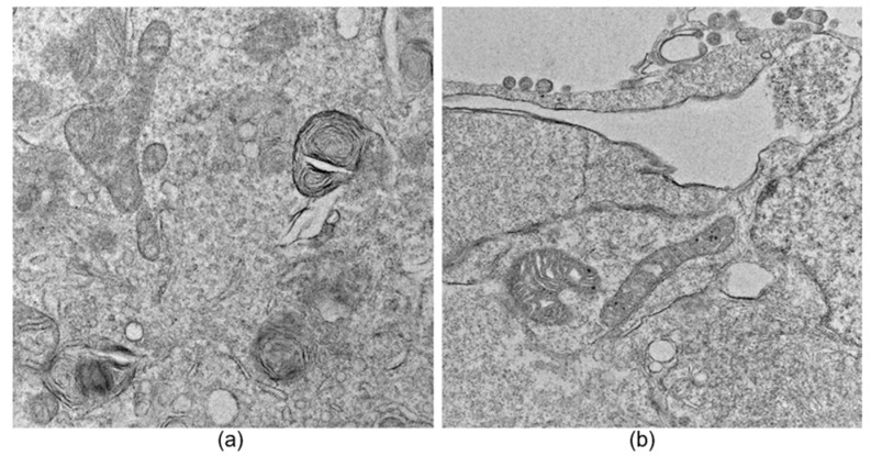 Deep Learning-Based Automatic Segmentation and Analysis of Mitochondrial Damage by Zika Virus and SARS-CoV-2.