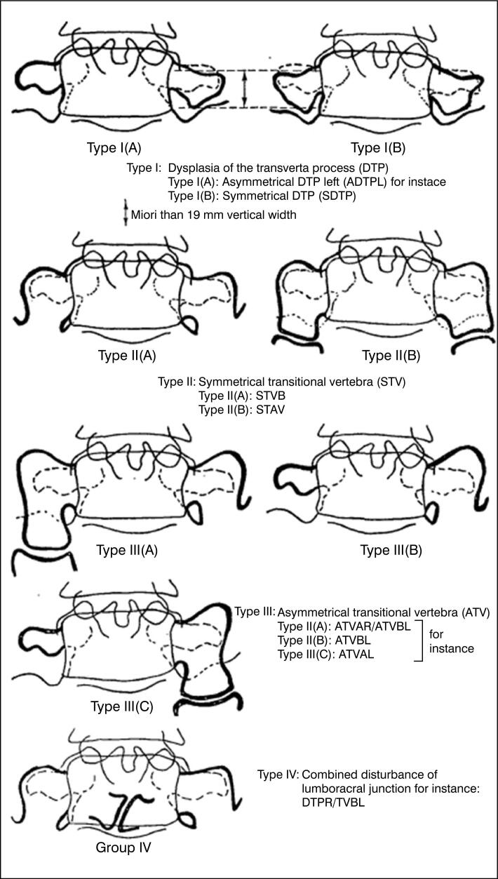 BERTOLOTTI SYNDROME.