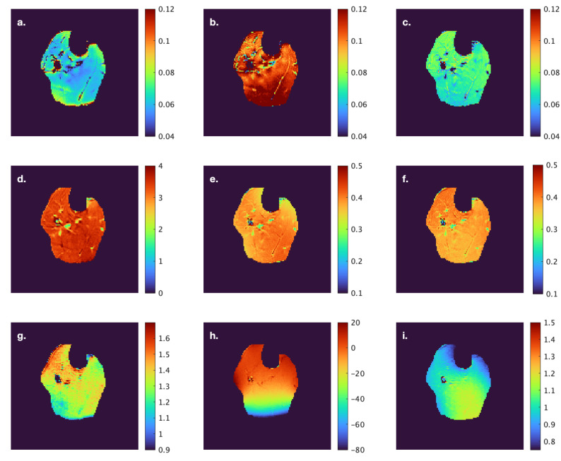 Evaluation of Magnetization Transfer Contrast Sequences: Application to Monitor Age-Related Differences in Muscle Macromolecular Fraction.