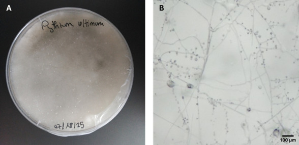 In Vitro Screening of Microbial Extracts Against the Oomycetes <i>Phytophthora capsici</i> and <i>Pythium ultimum</i>.