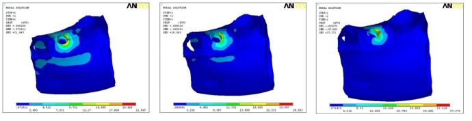Biomechanical Analysis of Stress Distribution and Force Dynamics in Nobel Active Implants at Varying Angulations: A Finite Element Study.