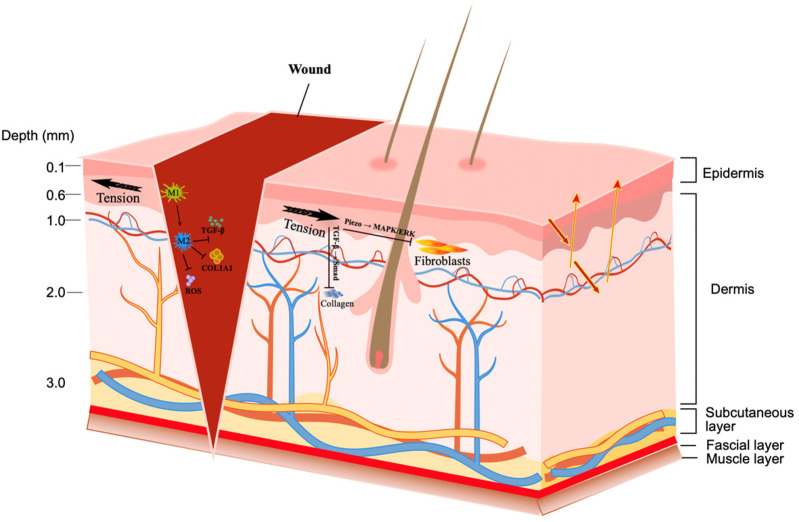 Biomechanical mechanism and clinical management progress of surgical wound tension.