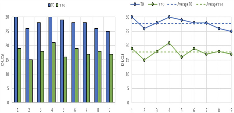 Guselkumab In A Subset Of Multifailure Patients With Hidradenitis Suppurativa: Real-Word Evidence from Federico II.