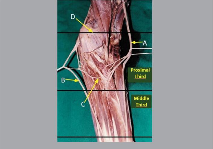 ANATOMOTOPOGRAPHIC STUDY OF THE MARTIN-GRUBER ANASTOMOSIS.