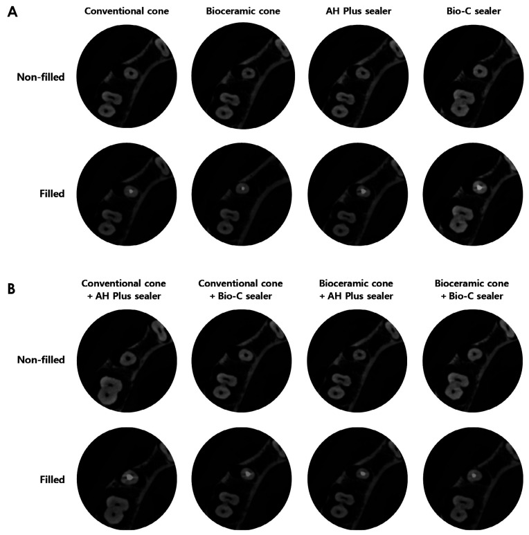 Enhancing image quality: The role of low-radiopacity bioceramic materials in CBCT scans.