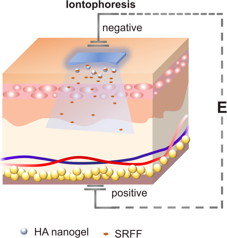 Iontophoretic Delivery of Hyaluronic Acid Nanogel-Loaded Fermented Rice Extract Mitigates Skin Glycation.