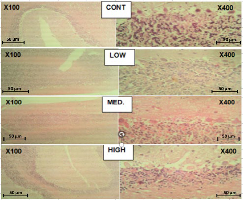 Effect of codeine administration on histopathology of brain and liver, in adult albino rats.