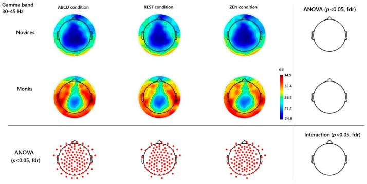 Neural Pattern of Chanting-Driven Intuitive Inquiry Meditation in Expert Chan Practitioners.