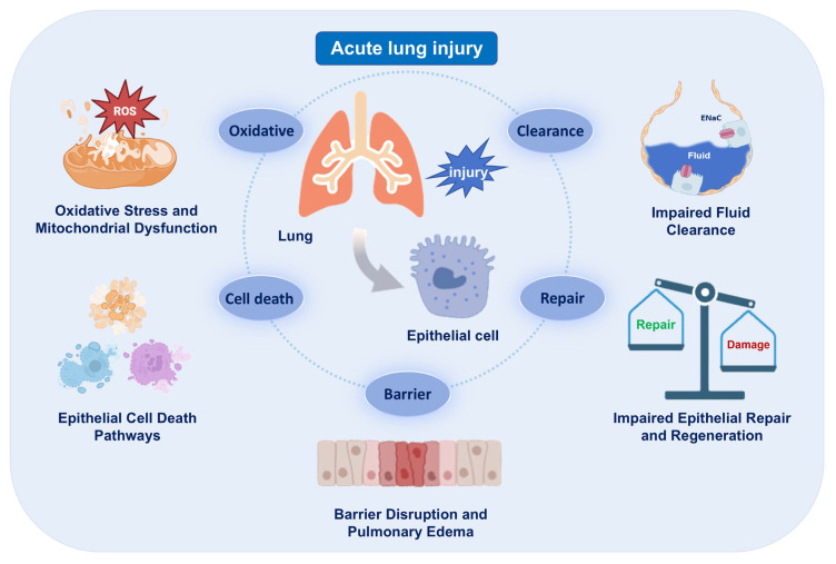 Alveolar Epithelial Cell Dysfunction in Acute Respiratory Distress Syndrome: Mechanistic Insights and Targeted Interventions.