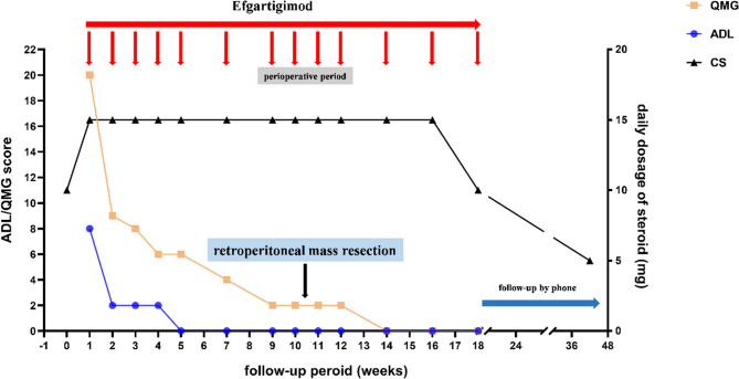 Perioperative Efgartigimod treatment for acute myasthenia gravis exacerbation with retroperitoneal mass: a case report.