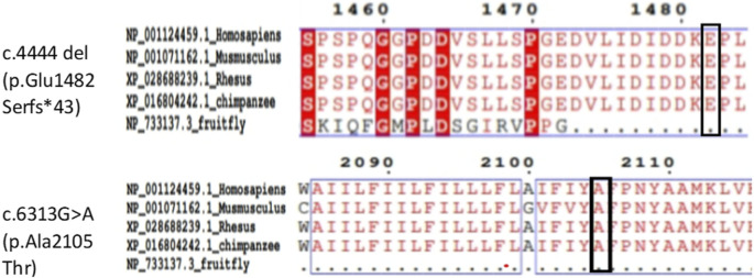 Uncovering compound heterozygous <i>DYSF</i> variants in a Chinese family affected by limb-girdle muscular dystrophy type 2B.