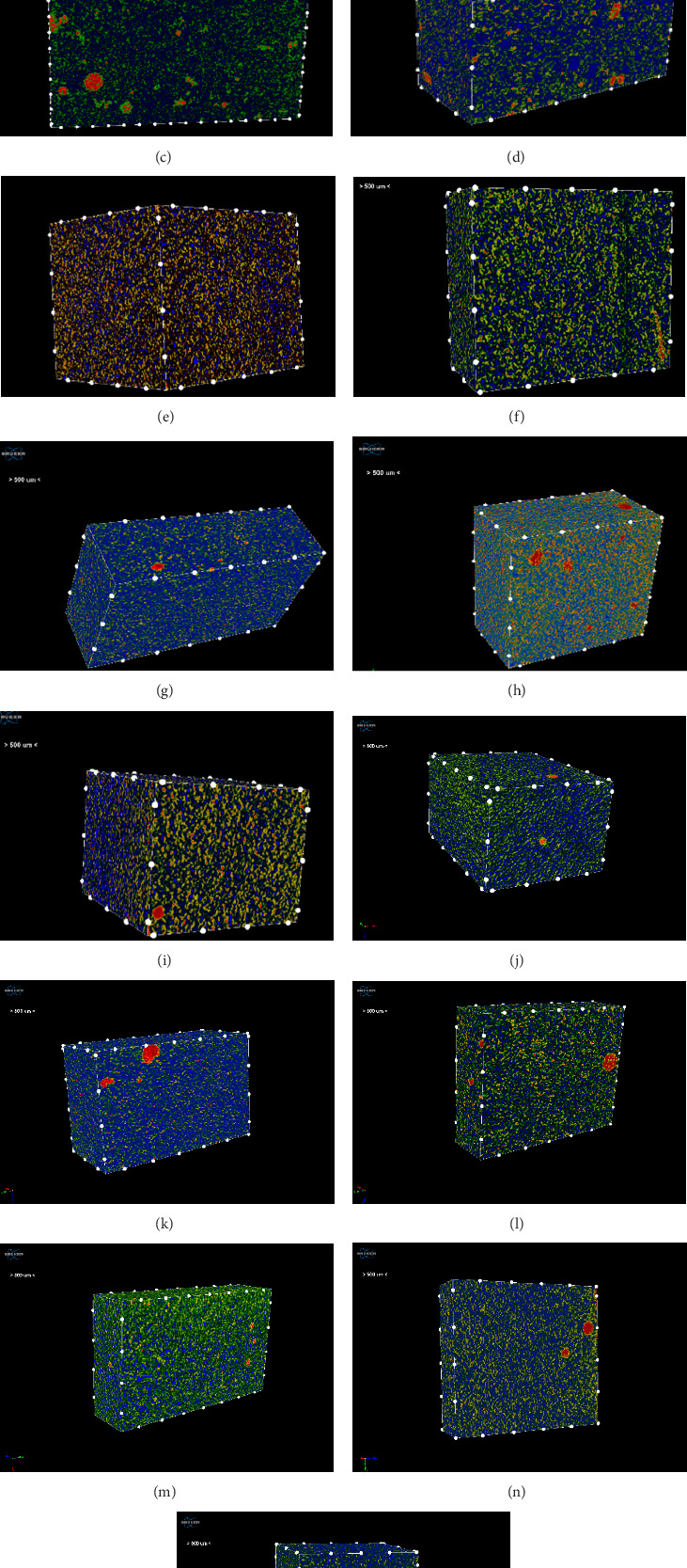 Quantitative Analysis of Closed Porosity in Direct Resin Composites: A Micro-CT Study on the Influence of Material Type.