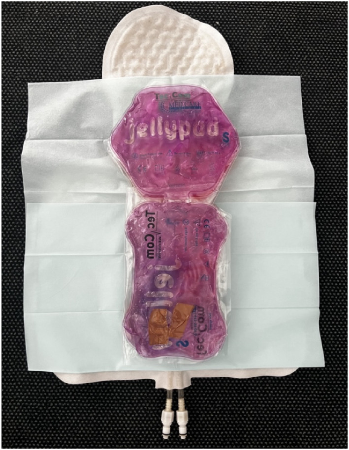 Evaluating the Impact of the Wrapping Bag <i>TECOtherm Wrabbit</i> on Temperature Stability During Therapeutic Hypothermia Treatment of Hypoxic Ischemic Encephalopathy.