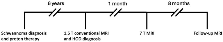 Hypertrophic olivary degeneration: a 7 Tesla advanced imaging case report.