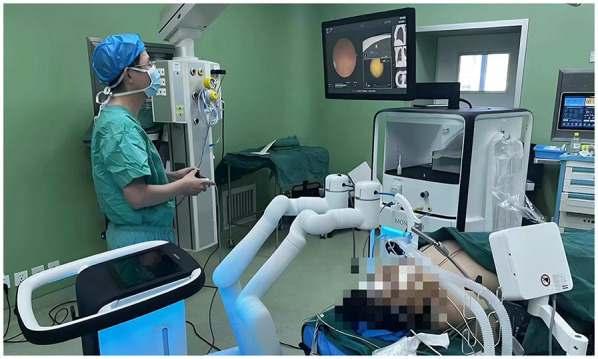 Robotic-assisted bronchoscopic localization for small pulmonary nodules: a novel approach to minimally invasive surgery.