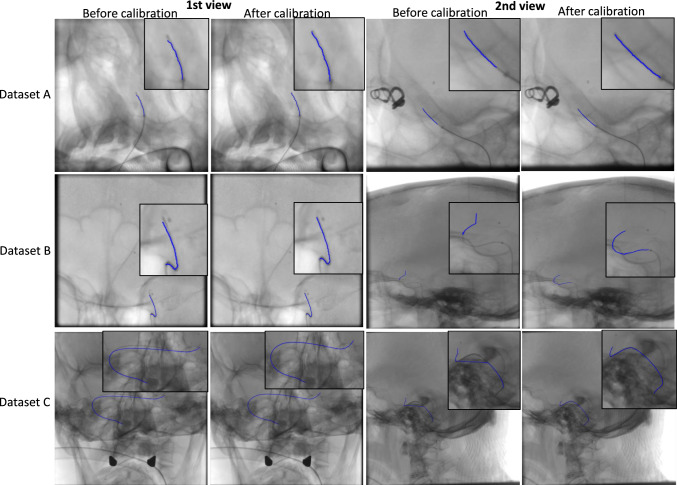 Semi-automatic segmentation of elongated interventional instruments for online calibration of C-arm imaging system.