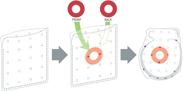 Preclinical and clinical evaluation of ECM bioenvelopes for preventing CIED pocket complications.
