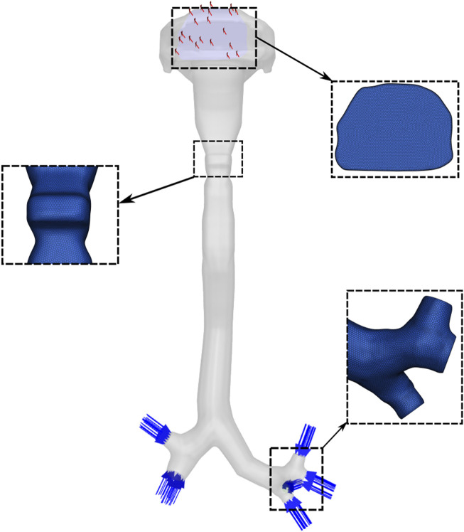Computational modeling of cough-induced droplets and mucosal film dynamics in the upper airway for pulmonary disease classification.