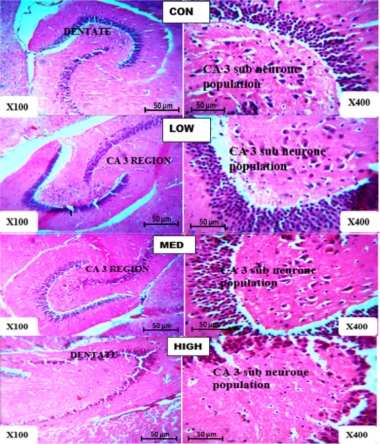 Effect of codeine administration on histopathology of brain and liver, in adult albino rats.
