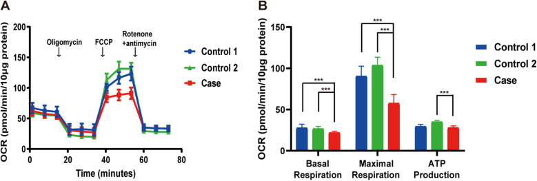 Case Report: Biallelic variants in <i>MRPS36</i>, encoding a component of the 2-oxoglutarate dehydrogenase complex, cause leigh syndrome.