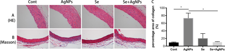 Intratracheal Instillation of Silver Nanoparticles to Rats Induces Mitochondrial Fission and Aortic Damage: Protective Effect of Sodium Selenite.