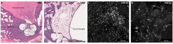 Schwann cells in the inner ear: development, disease, and regeneration.