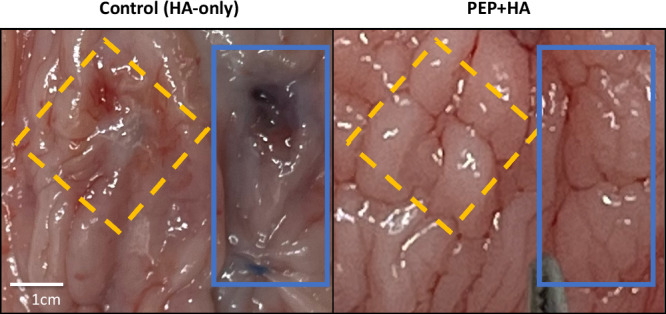 Exosome injection as a prevention strategy for early postoperative mesh complications in a porcine model of sacrocolpopexy.