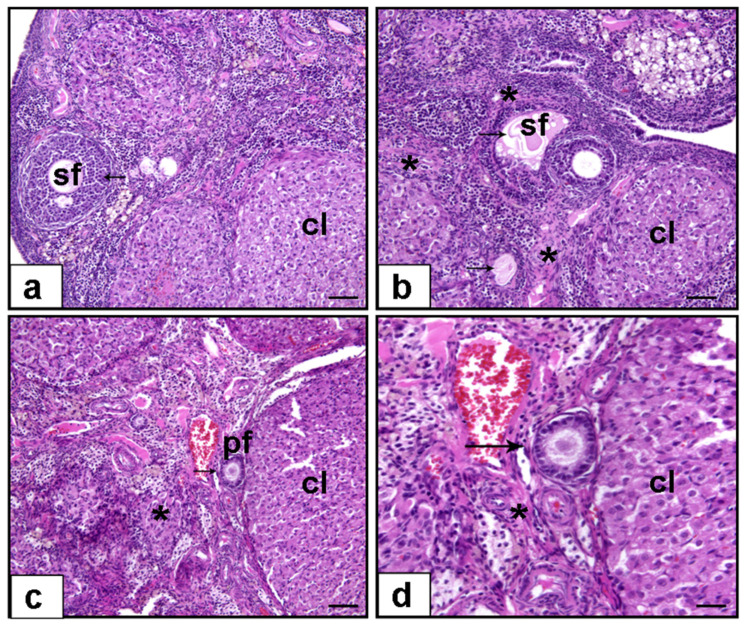 Krill Oil Mitigates Cisplatin-Induced Ovarian Toxicity via Attenuation of Oxidative Stress and Inflammatory Pathways.