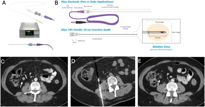 The growing armamentarium of image-guided tumor ablation in interventional oncology.