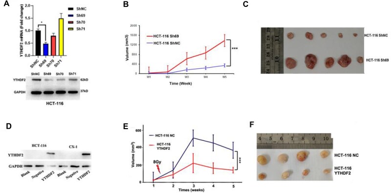 YTHDF2 alleviates the radioresistance of rectal cancer cells by targeting methylated MYC.