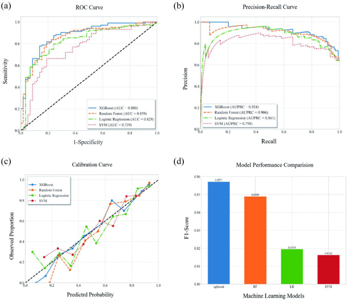Machine learning-based prediction of response to Ustekinumab with Crohn's disease.