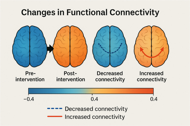 Advances in Neuroimaging of Breast Cancer Pain: An Overview.