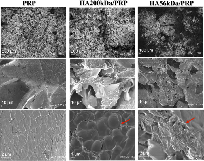 Novel platelet-rich plasma/ hyaluronic acid lyophilized formulations for wound healing applications.