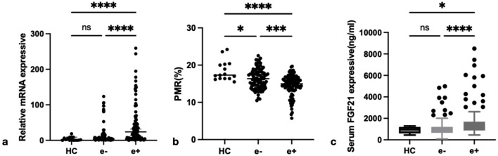 The value of fibroblast growth factor 21 (FGF21) promoter methylation in the repair and regeneration during the course of chronic hepatitis B.