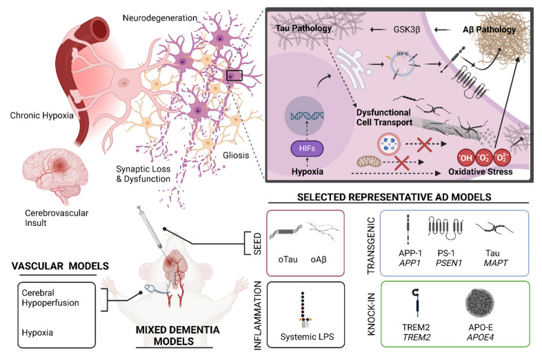 The pathophysiology of mixed Alzheimer's disease and vascular dementia.