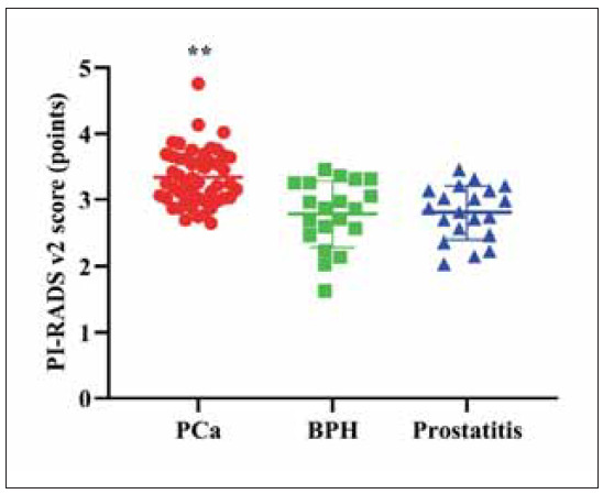 Combination of prostate cancer antigen 3 (PCA3), sarcosine, glypican-1 (GPC1), urokinase plasminogen activator receptor (uPAR), and thymidine kinase 1 (TK1), and T2WI and DWI radiomics model for distinguishing benign prostatic hyperplasia, prostate cancer, and prostatitis.