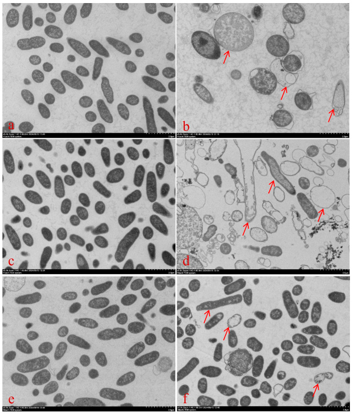 Postβ-Lactamase-Inhibiting Effect of Sulbactam in Combination with Ceftriaxone on Extended-Spectrum-β-Lactamase-Producing <i>Escherichia coli</i>.