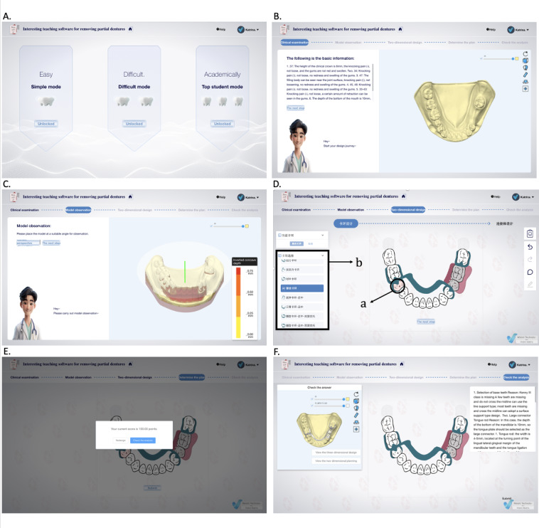 Enhancing Preclinical Training for Removable Partial Dentures Through Participatory 3D Simulation: Development and Usability Study.