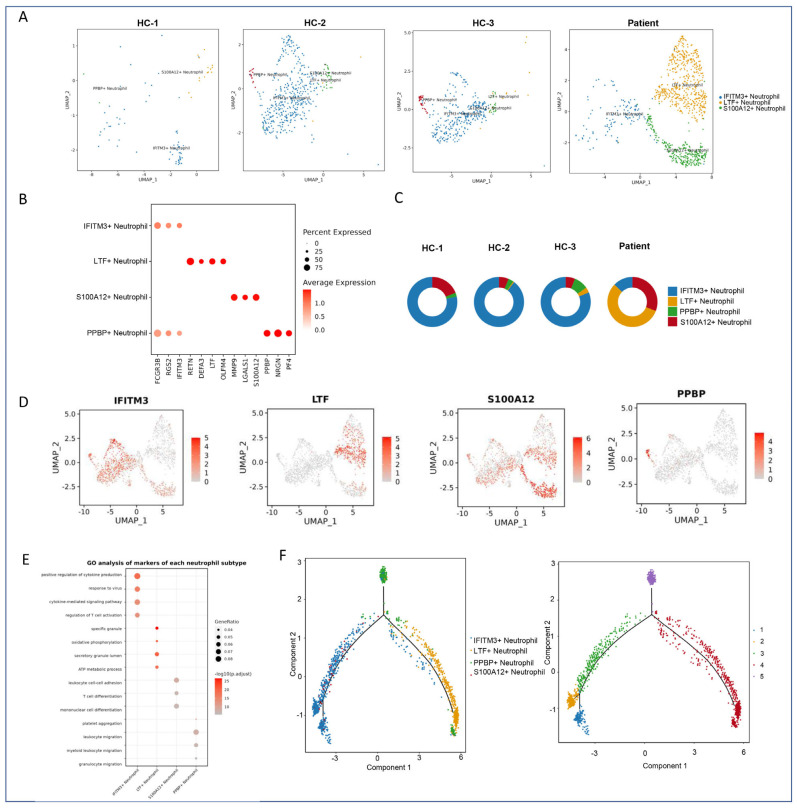 Single-Cell Transcriptomic Analysis Reveals Cell Heterogeneity and Altered Signaling Pathways in Jellyfish Sting Patients.