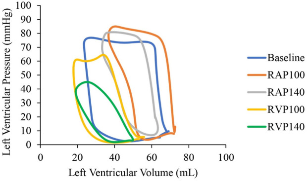 Acute effects of mechanical dyssynchrony on left ventricular function and coronary perfusion.