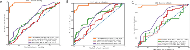 Predicting Axillary Lymph Node Metastasis in Breast Cancer Using Ultrasound and Machine Learning with SHAP.