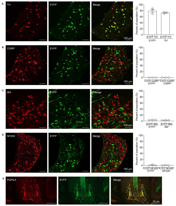 Identification of VGLUT3-expressing LTMRs-recruited spinal circuits for itch inhibition.