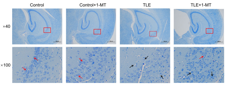 IDO Activation Affects BDNF/TrkB Signaling Pathway, Oxidative Stress, and Mitochondrial Enzymatic Activities in Temporal Lobe Epilepsy.