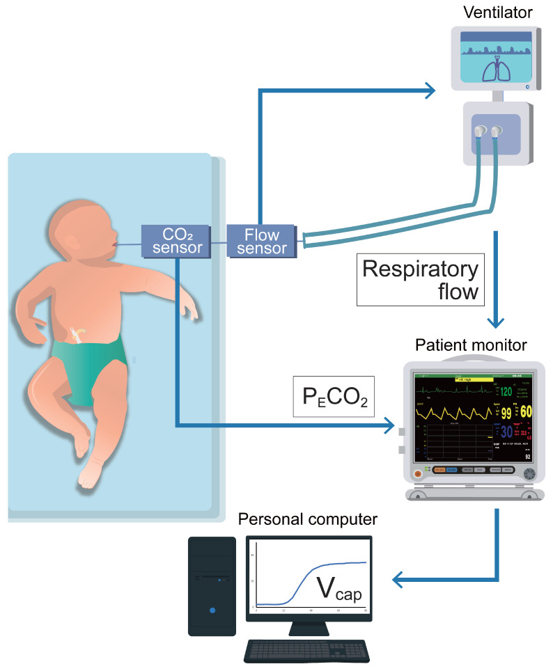 High PEEP Increases Airway Dead Space and Decreases Alveolar Ventilation: A New Technique for Volumetric Capnography.