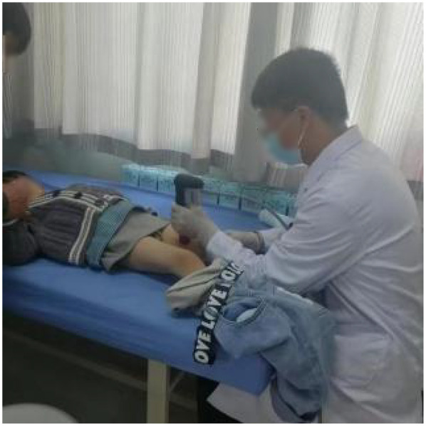 Radial extracorporeal shock wave promotes the treatment of non-union of femoral shaft fractures in children: a case report.