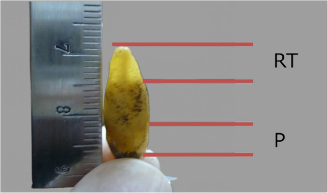 Evaluating the accuracy of root transparency and periodontosis age estimation models in a Portuguese population.